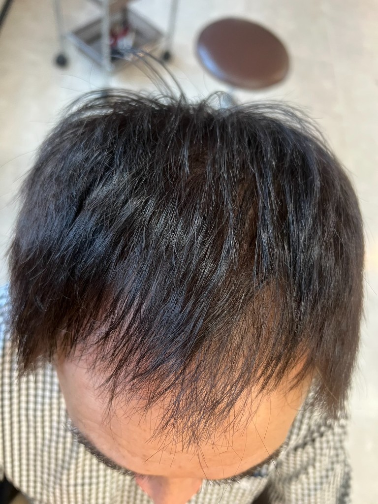 施術後